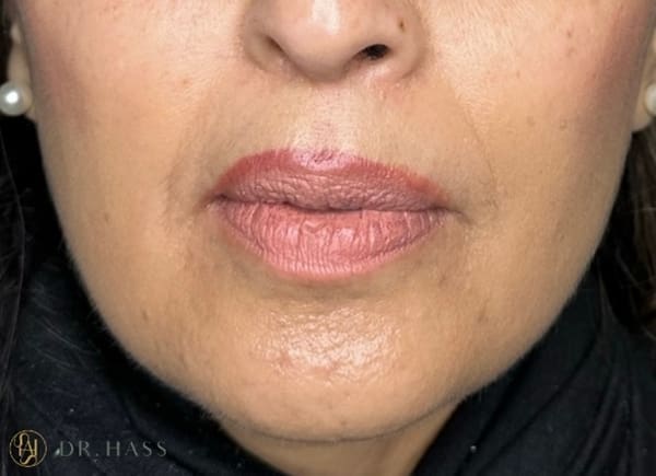 Lips
