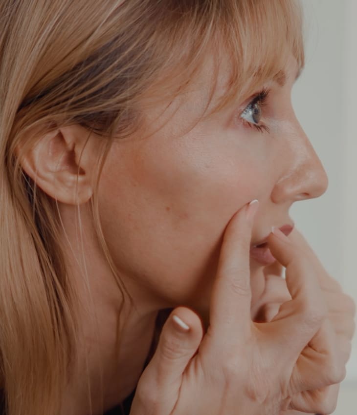 Female Patient After Endolift at Dr Hass Clinic in London