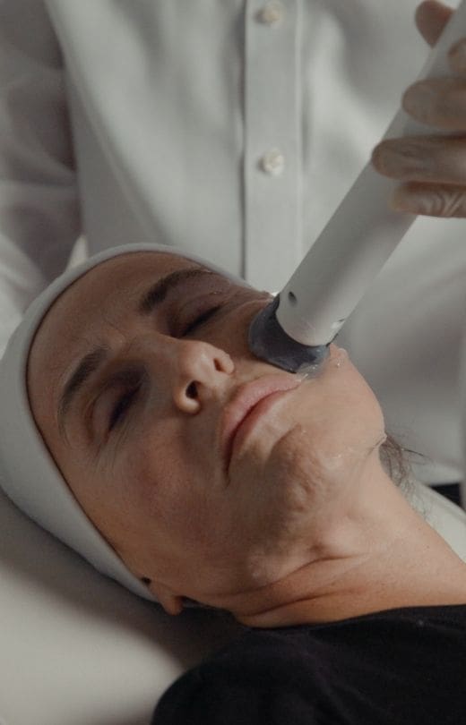 XERF treatment along the cheek and jawline