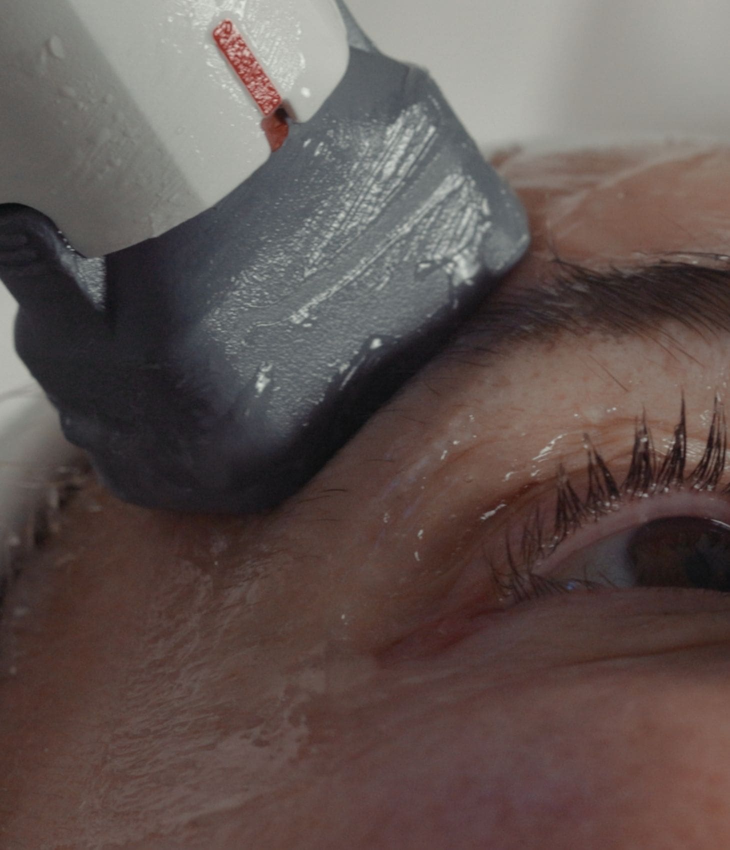 Close-up of the XERF handpiece treating the brow