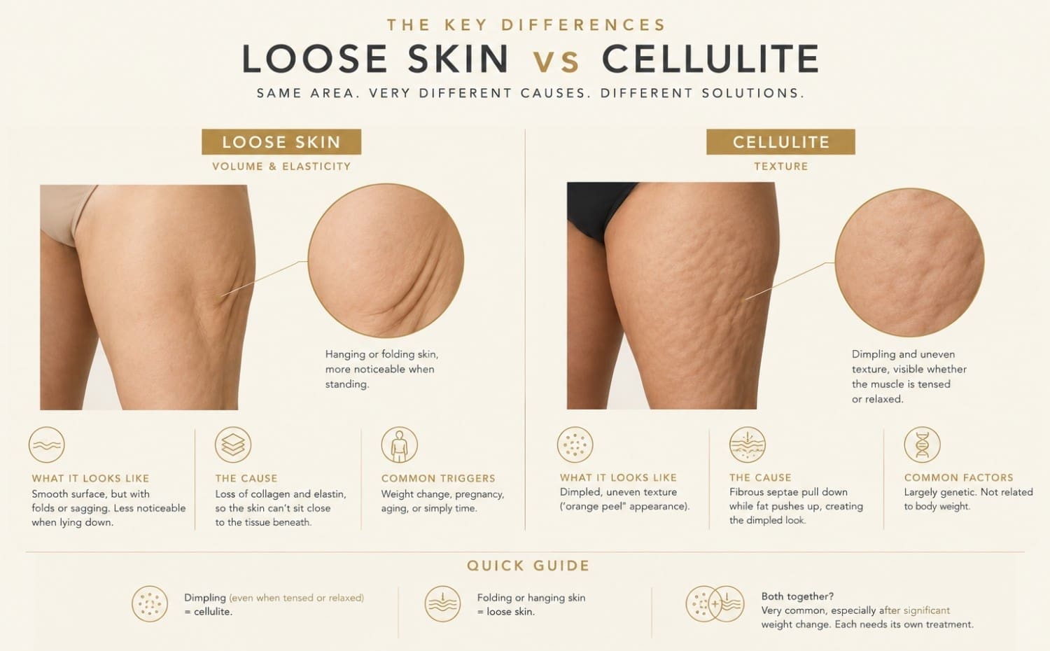 Loose Skin vs Cellulite - Dr Hass Clinic